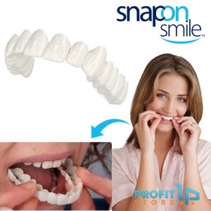 Snap Smile - Μασελάκι για Υπέροχο Χαμόγελο - Αφαιρούμενη Οδοντική Όψη Ρητίνης Άνω ή Κάτω Γνάθου