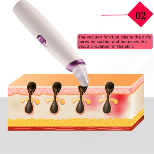 Συσκευή Καθαρισμού Προσώπου με 4 Κεφαλές - Απολέπιση, Σύσφιξη και Απομάκρυνση Μαύρων Στιγμάτων