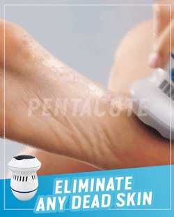 Ηλεκτρική Μηχανή Αφαίρεσης Κάλων & Νεκρών Κυττάρων-Foot Treat ΟΕΜ