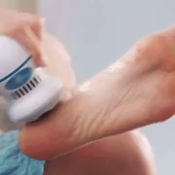 Ηλεκτρική Μηχανή Αφαίρεσης Κάλων & Νεκρών Κυττάρων-Foot Treat ΟΕΜ