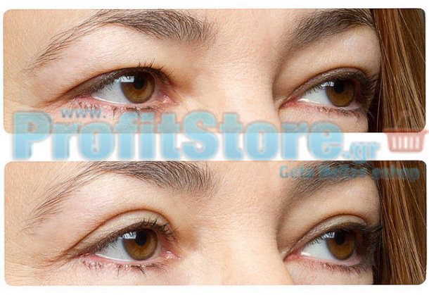 Αυτοκόλλητο Ανόρθωσης Βλεφάρου Eyelid Lift Strips 600 Τεμάχια