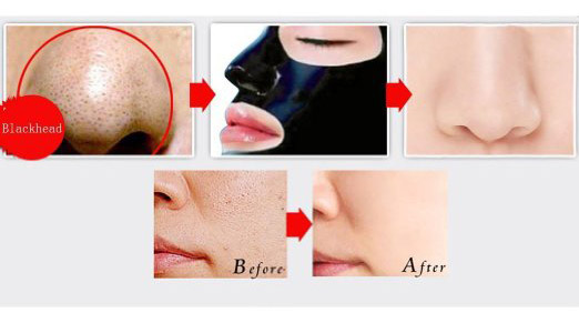 Black Mask - Μαύρη Μάσκα Προσώπου για Καθαρισμό από Μαύρα Στίγματα 50ml