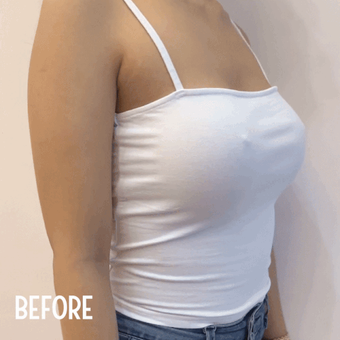 Αόρατα Καλύμματα Θηλής 2τμχ - Nipple Silicone Pad