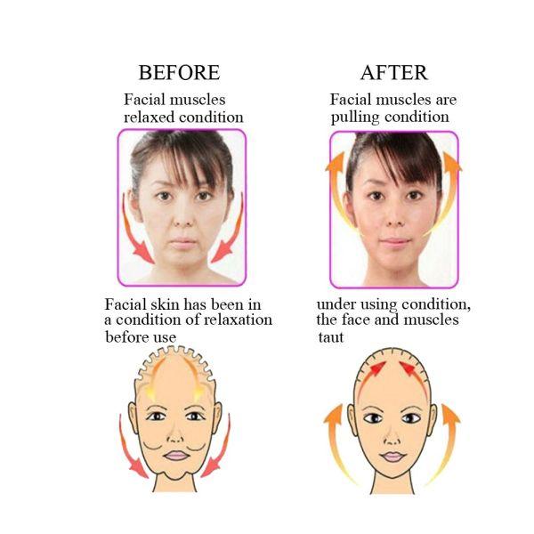 Συσκευή Εκγύμνασης Προσώπου - Δέρμα Σφιχτό Χωρίς Ρυτίδες - Glamza Lip Shape Face Exercise