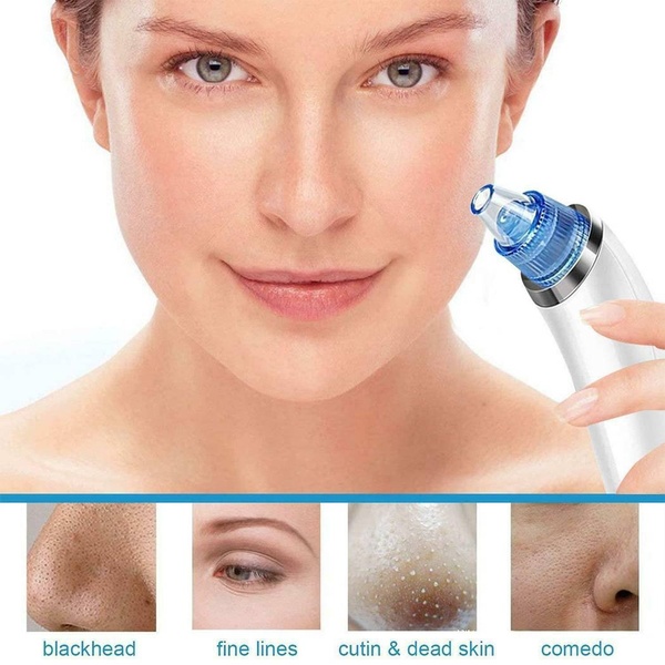 Blackhead DermaSuction για τον Καθαρισμό του Προσώπου από τα Μαύρα Στίγματα