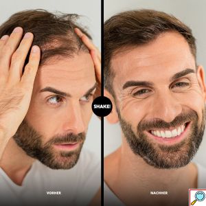 Σετ SHAKE OVER Spray Maximizer Applicator & Χτενάκι για Κατευθυνόμενο Ψεκασμό Μικροινών Κερατίνης