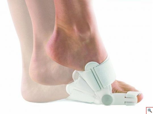 Νάρθηκας για το Κότσι με Κινούμενο Βραχίονα - Άρθρωση Bunion Aid