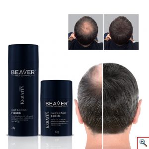Beaver Hair Building Fibers, Μικρο-ίνες Φυσικής Κερατίνης κατά της Τριχόπτωσης & Αραίωσης των Μαλλιών 12γρ