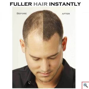 Beaver Hair Building Fibers, Μικρο-ίνες Φυσικής Κερατίνης κατά της Τριχόπτωσης & Αραίωσης των Μαλλιών 12γρ