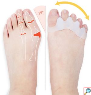 Σετ ToeRELIEF Spacer - Ευθυγραμμιστικό & Διαχωριστικό Δαχτύλων - Διορθωτής για Κότσι & Πρόληψης