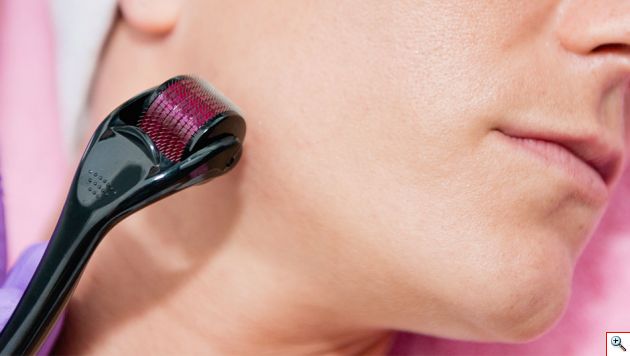 Συσκευή Μασάζ Προσώπου - Derma Roller 540 Needles 0.3mm Σύστημα με Μικροακίδες