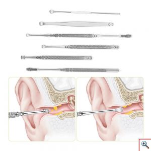 Σετ Εργαλεία Καθαρισμού Αυτιών - Glamza 6pc Ear Wax Removal Kit Πως να ξεβουλώσω το αυτί μου