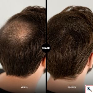 Μικρο-ίνες Φυσικής Κερατίνης με Ψευδάργυρο κατά της Τριχόπτωσης & Αραίωσης των Μαλλιών 30γρ - SHAKE-OVER Zinc-enriched Hair Fibers