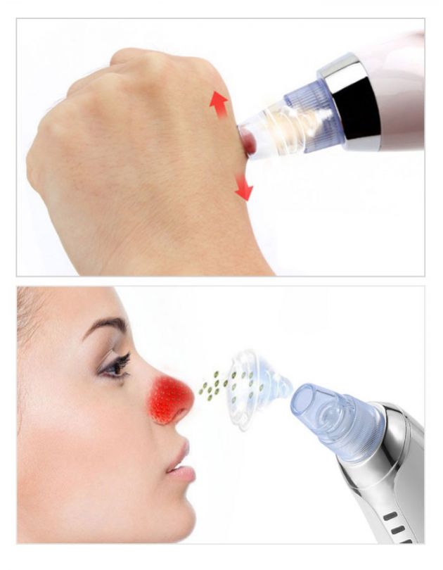 Blackhead SpotCleaner Professional XD5002 για τον Καθαρισμό του Προσώπου από τα Μαύρα Στίγματα