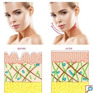 Συσκευή Περιποίησης - Μασάζ Προσώπου για Αντιγήρανση Mini Facial Toning Device 