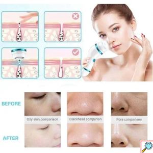 Ηλεκτρική Βούρτσα Καθαρισμού Προσώπου Περιστρεφόμενη με 4 Κεφαλές για Άντρες και Γυναίκες Cnaier Ροζ