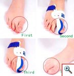 Νάρθηκας για το Κότσι - Σετ των 2 τεμαχίων