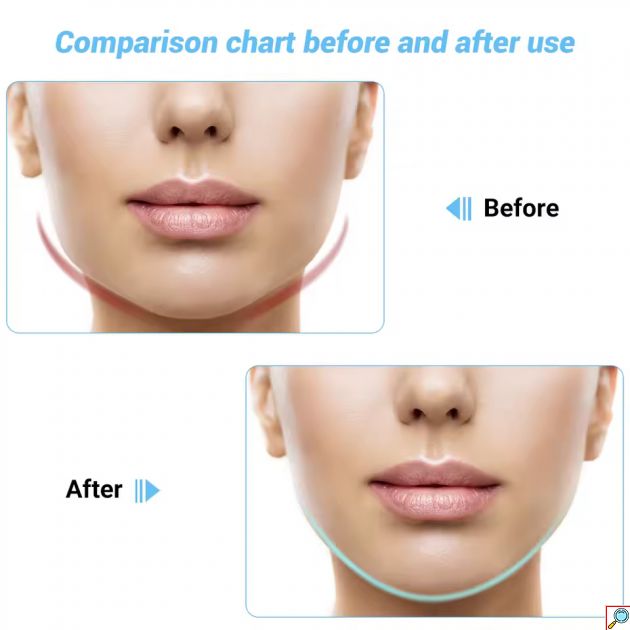 EMS Συσκευή Lifting Προσώπου & Σαγονιού με Δόνηση, LED & Θερμότητα