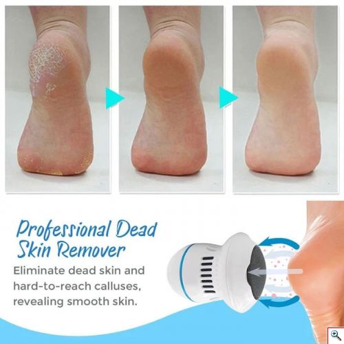 Ηλεκτρική Μηχανή Αφαίρεσης Κάλων & Νεκρών Κυττάρων-Foot Treat