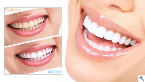 Ενεργός Άνθρακας Λεύκανσης Δοντιών - 100% Natural Activated Charcoal Teeth Whitening Powder 50gr