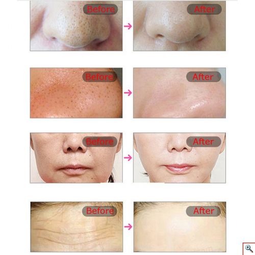 LED Μάσκα Προσώπου για Φωτοθεραπεία - New Light Therapy Mask