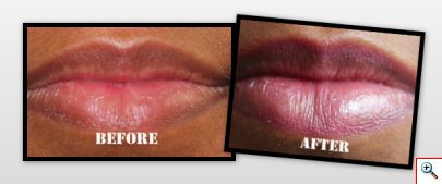  Full Lips Enhancer Pump για σαρκώδη και αισθησιακά χείλη