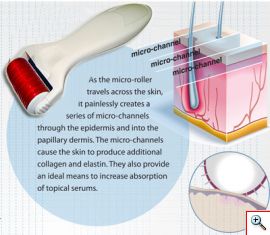 Body NeedleRoller - Επαγγελματική μέθοδος Ανανέωσης & Αντιγήρανσης