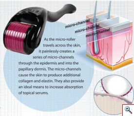 Micro NeedleRoller - Επαγγελματική μέθοδος Ανανέωσης & Αντιγήρανσης