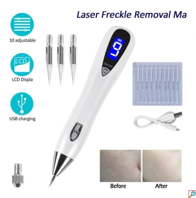 Ψηφιακό Plasma Pen για Σπίλους, Κηλίδες & Τατουάζ - 9 Επίπεδα Ισχύος με LCD Οθόνη & Φωτισμό