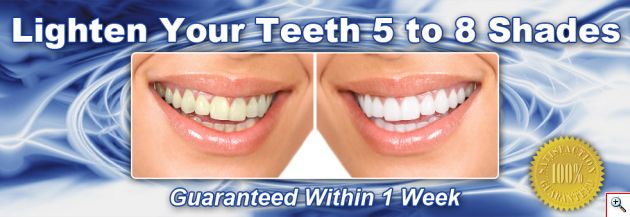 Express Σύστημα Λεύκανσης Δοντιών Glamza Hello Smile + 10ml Whitening Gel