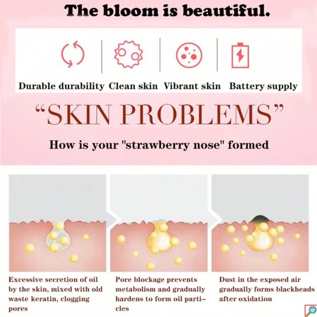 Συσκευή Καθαρισμού Προσώπου με 4 Κεφαλές - Απολέπιση, Σύσφιξη και Απομάκρυνση Μαύρων Στιγμάτων