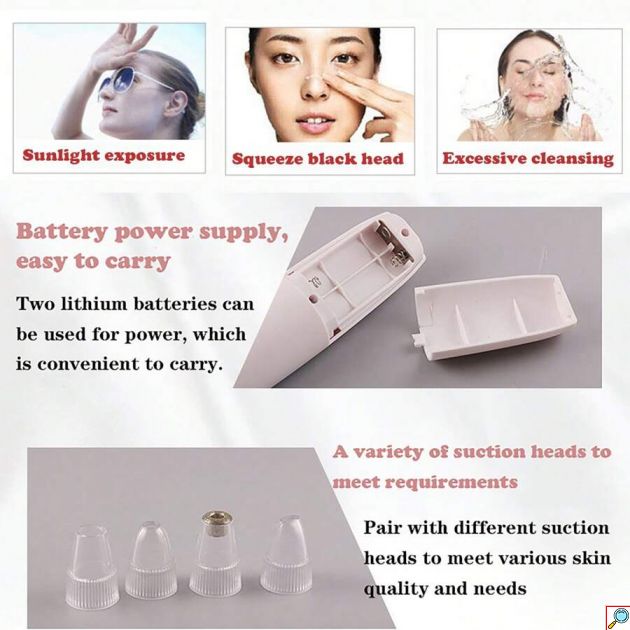 Συσκευή Καθαρισμού Προσώπου με 4 Κεφαλές - Απολέπιση, Σύσφιξη και Απομάκρυνση Μαύρων Στιγμάτων