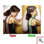 Θεραπευτικό Ανατομικό Μαξιλάρι Αυχένα και Πλάτης για Ύπνο στο Πλάι - Maxtop